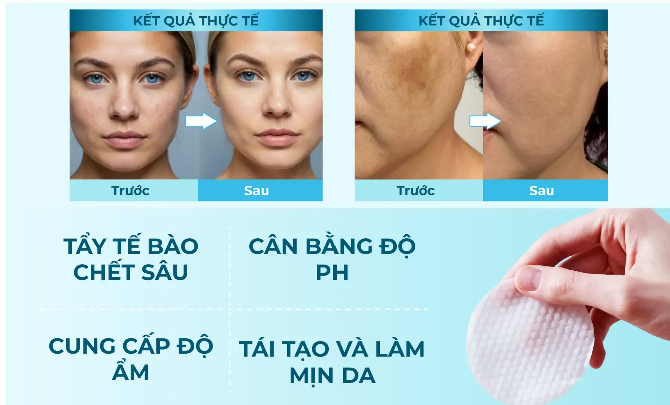 DUALCLEAR PADS – Miếng pad tẩy tế bào chết da mặt chứa Glycolic Acid, Salicylic Acid và các vitamin B3, B5, B8 Hỗ trợ cải thiện kết cấu da và thu nhỏ lỗ chân lông – Hộp 70 miếng