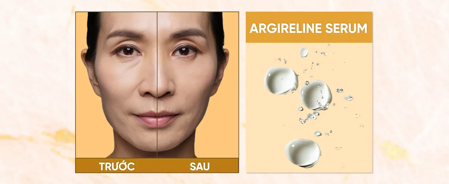 Argireline Serum – Chống Nhăn Hiệu Quả Cho Làn Da Tươi Trẻ