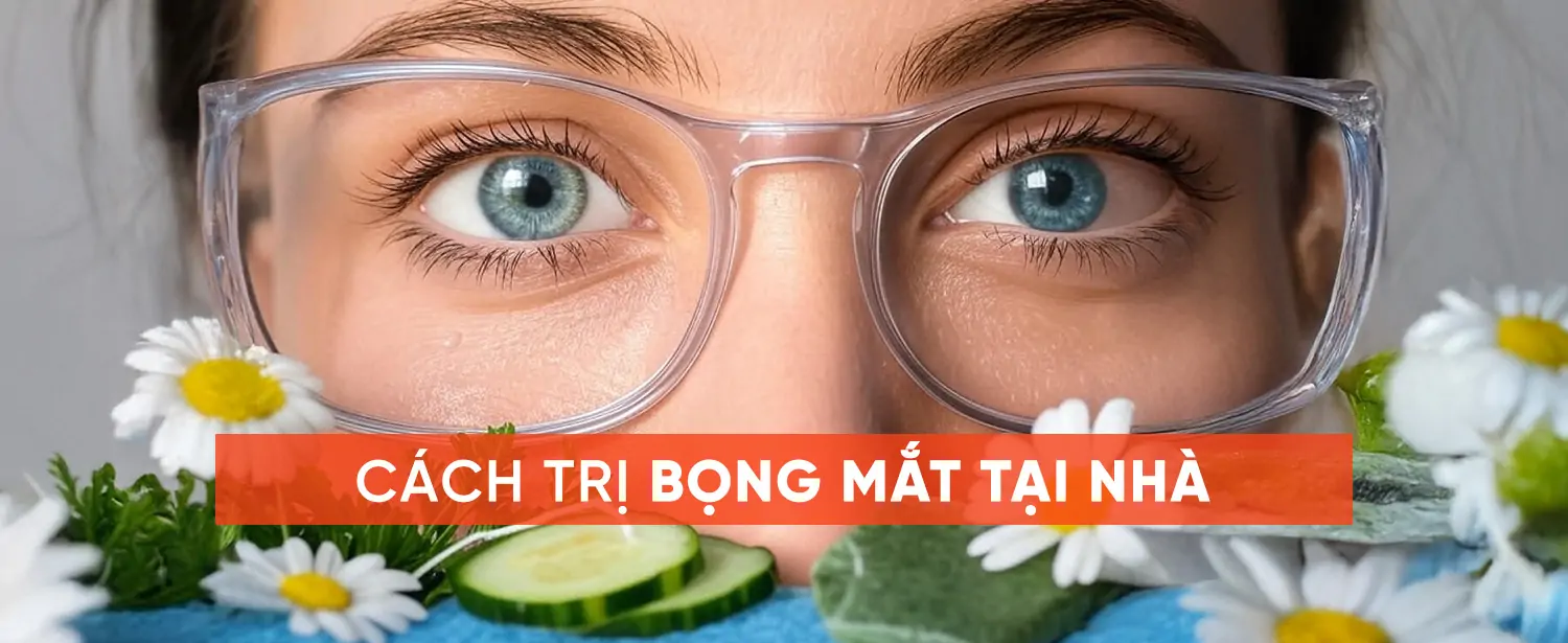 Cách Trị Bọng Mắt Tại Nhà – Giải Pháp Đơn Giản và Hiệu Quả