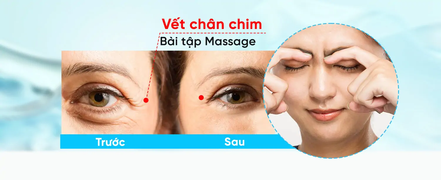 Trị Vết Chân Chim: Giải Pháp Làm Sáng Da Mắt Và Giảm Nếp Nhăn - Eyelift Serum