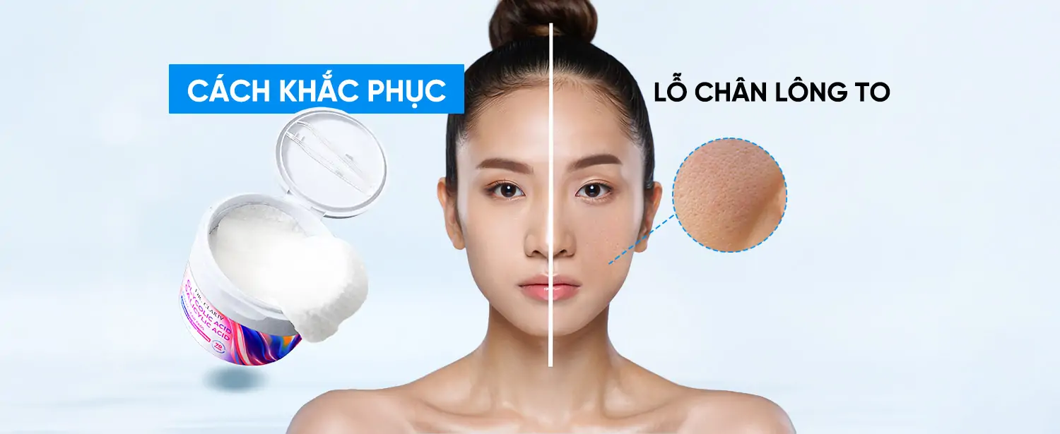 Lỗ Chân Lông To – Cách Khắc Phục & Se Khít Hiệu Quả Cho Da Mặt - DUALCLEAR PADS - DR.CLARIV